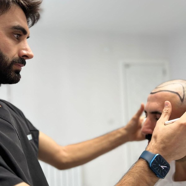 DEM Hair saç çizgisi tasarımı