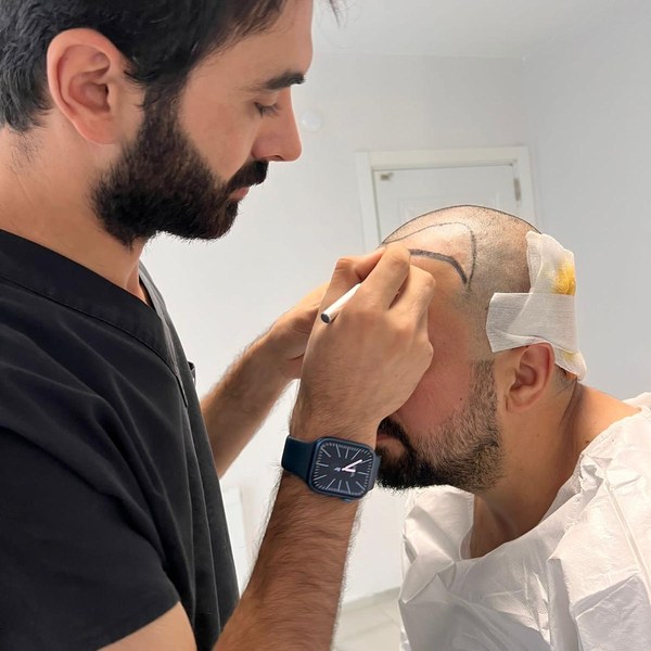 DEM Hair konsültasyon