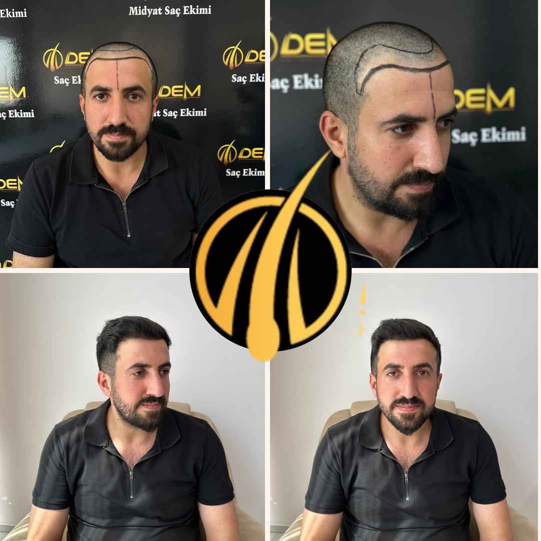 DEM sonuç 5