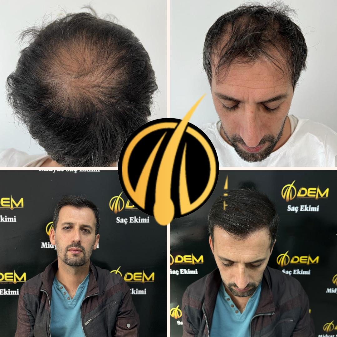 DEM sonuç 7