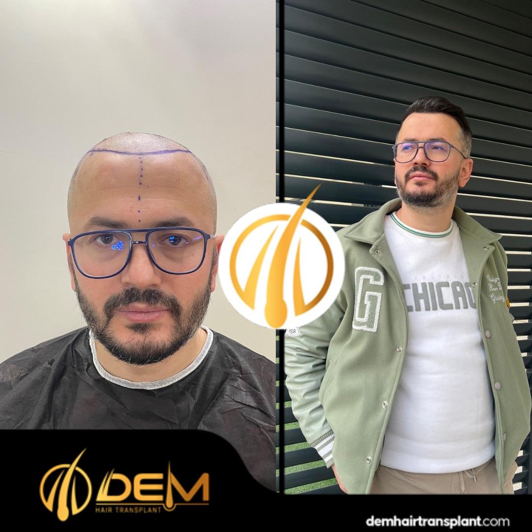 DEM sonuç 11