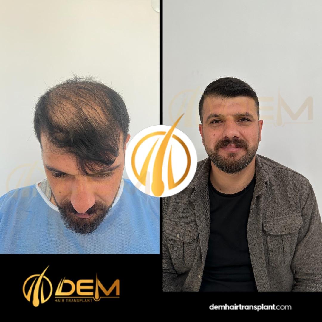 DEM sonuç 12
