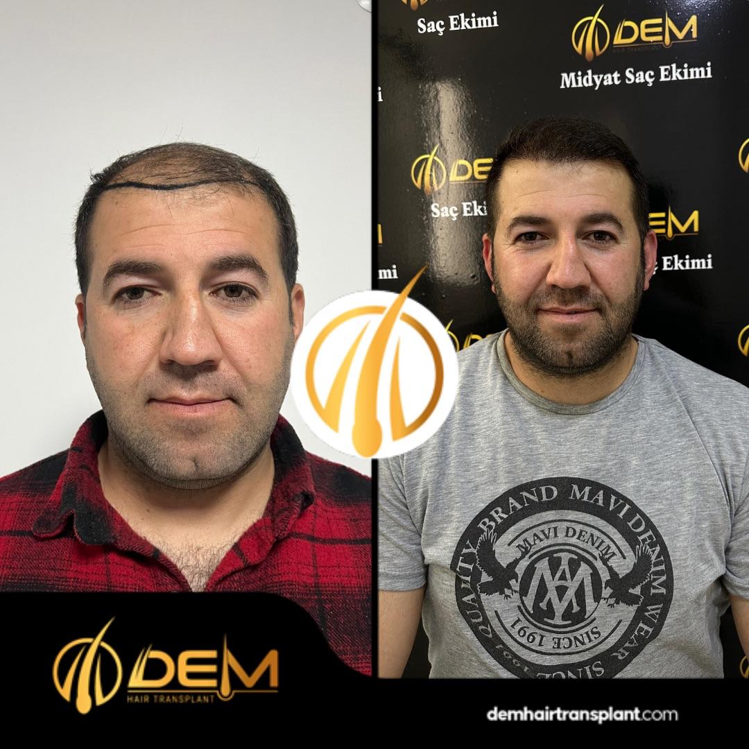 DEM sonuç 13