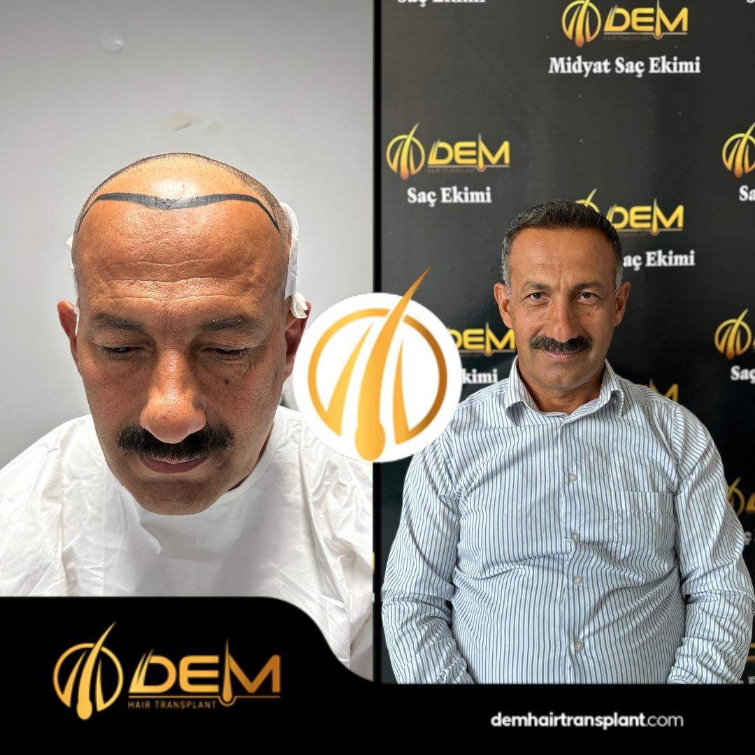 DEM sonuç 14
