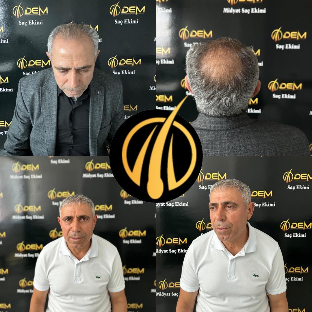 DEM sonuç 18