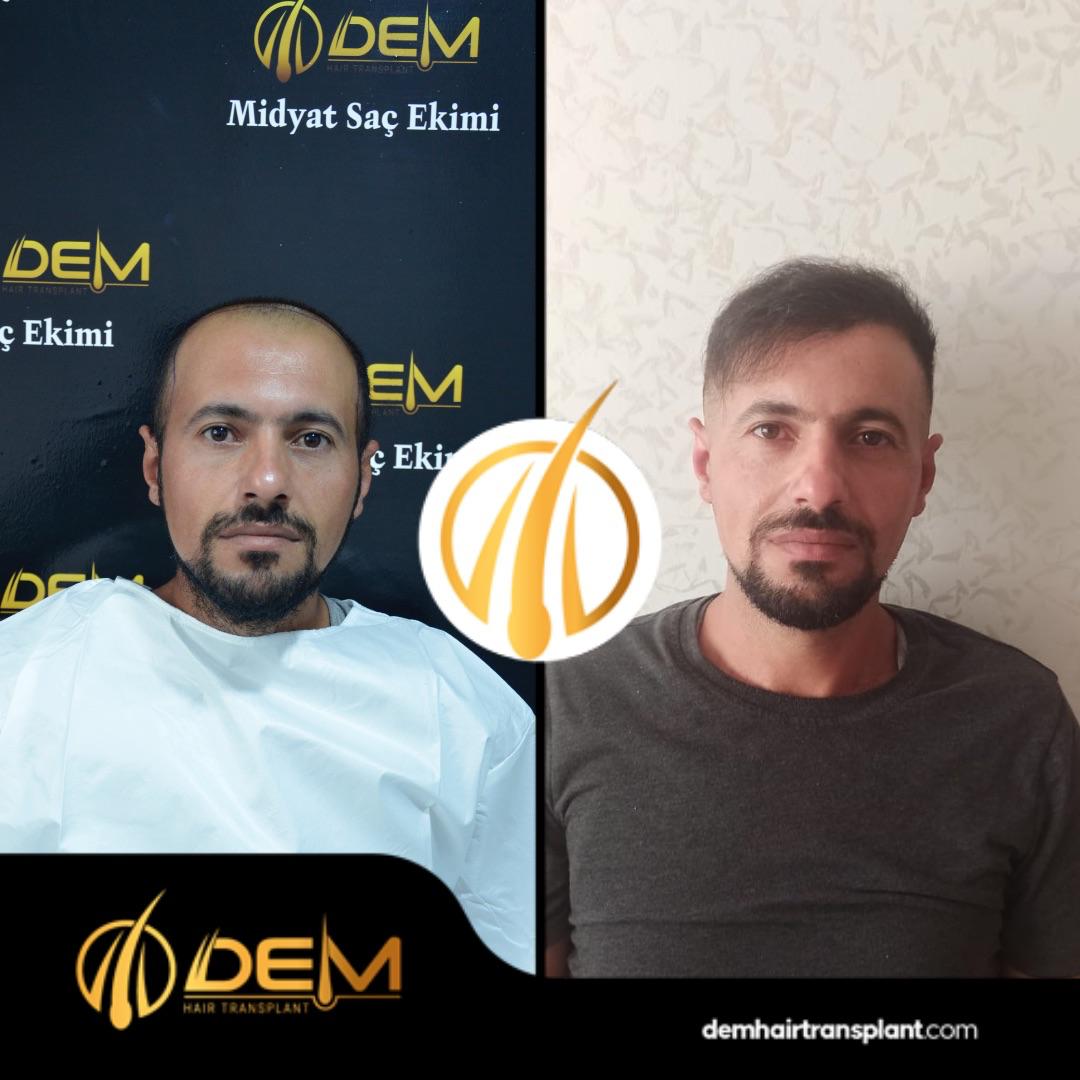 DEM sonuç 19