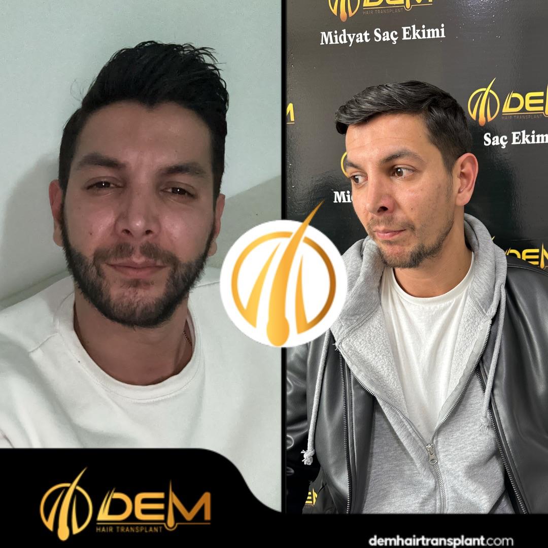 DEM sonuç 23
