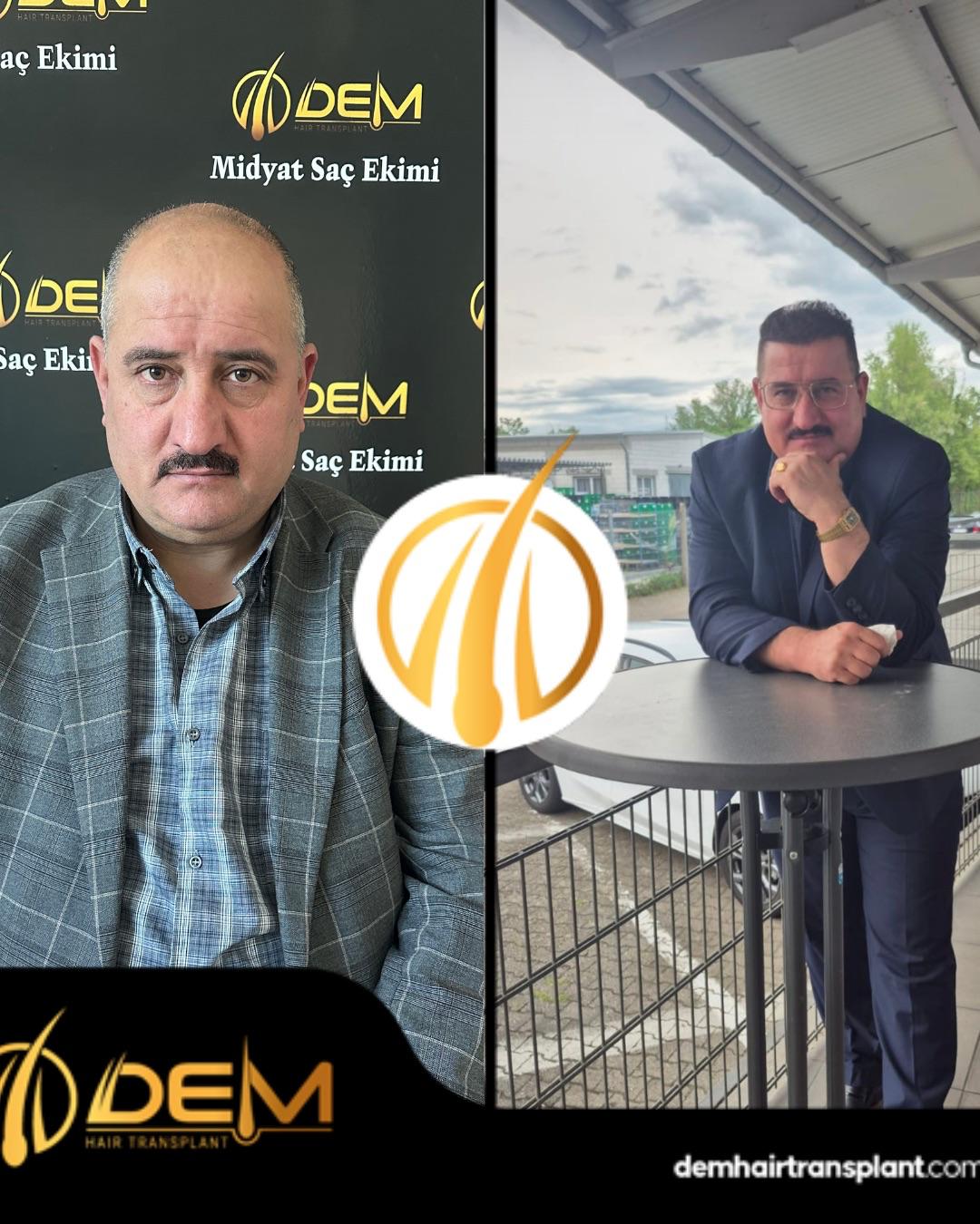 DEM sonuç 24