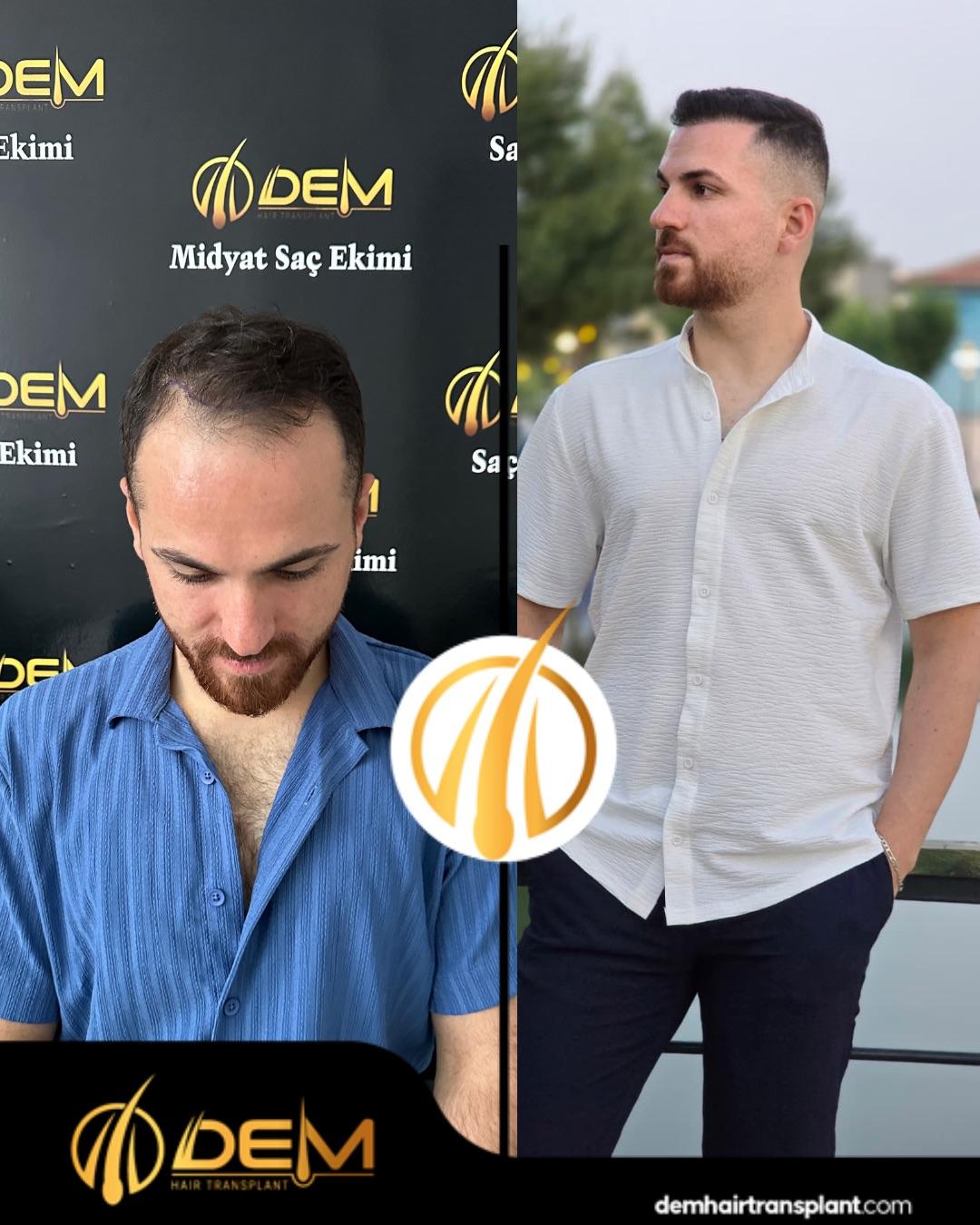 DEM sonuç 26