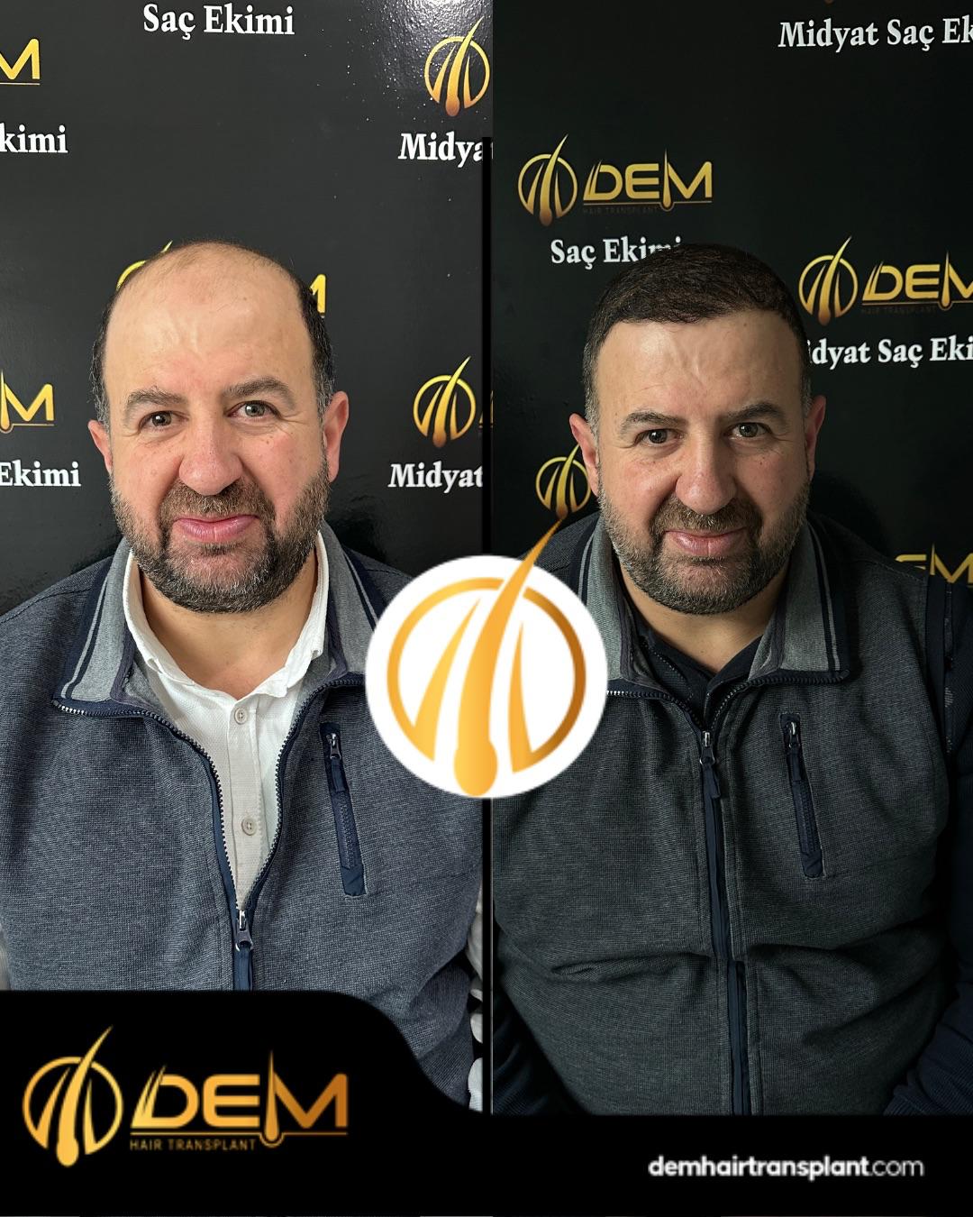 DEM sonuç 27