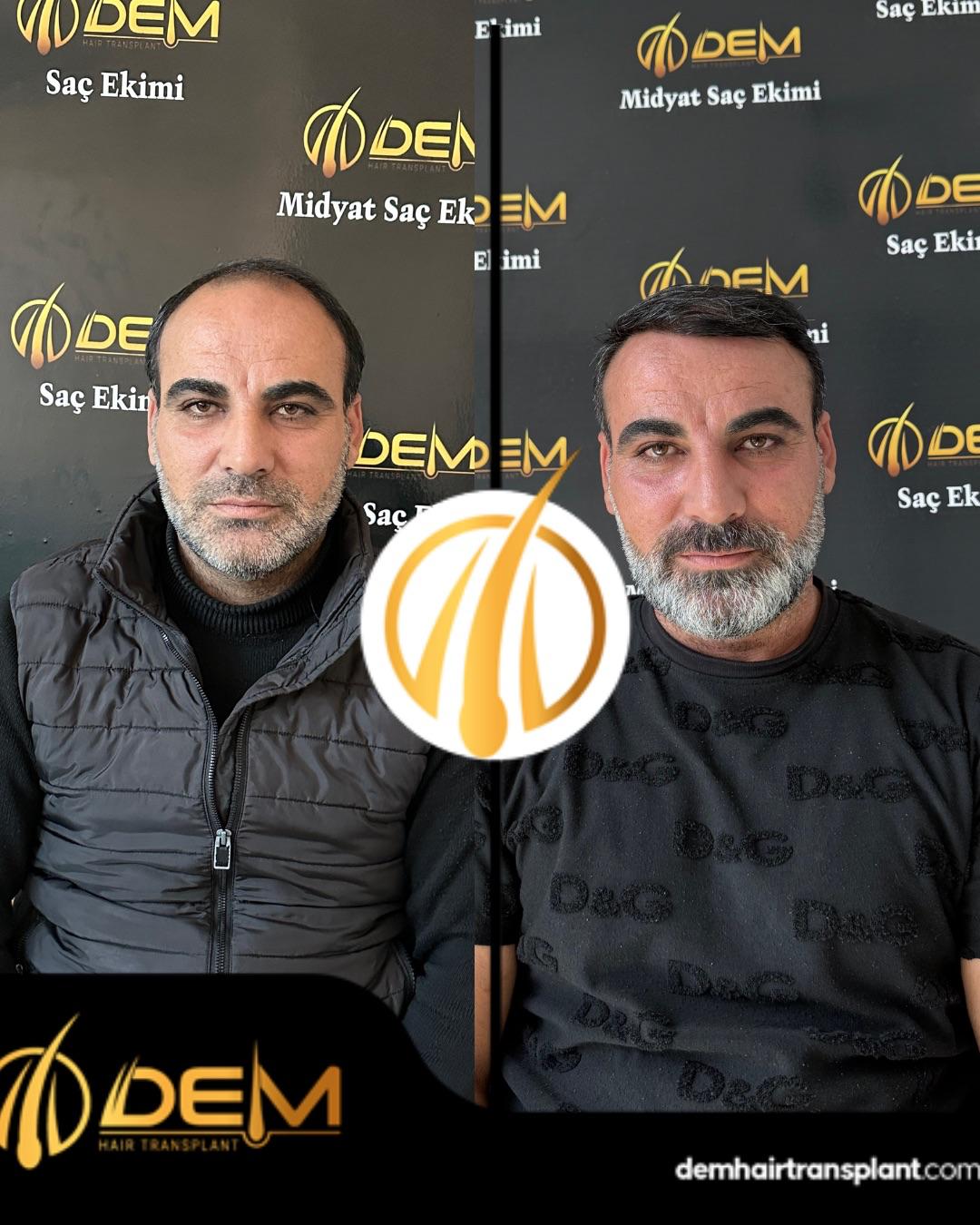 DEM sonuç 29