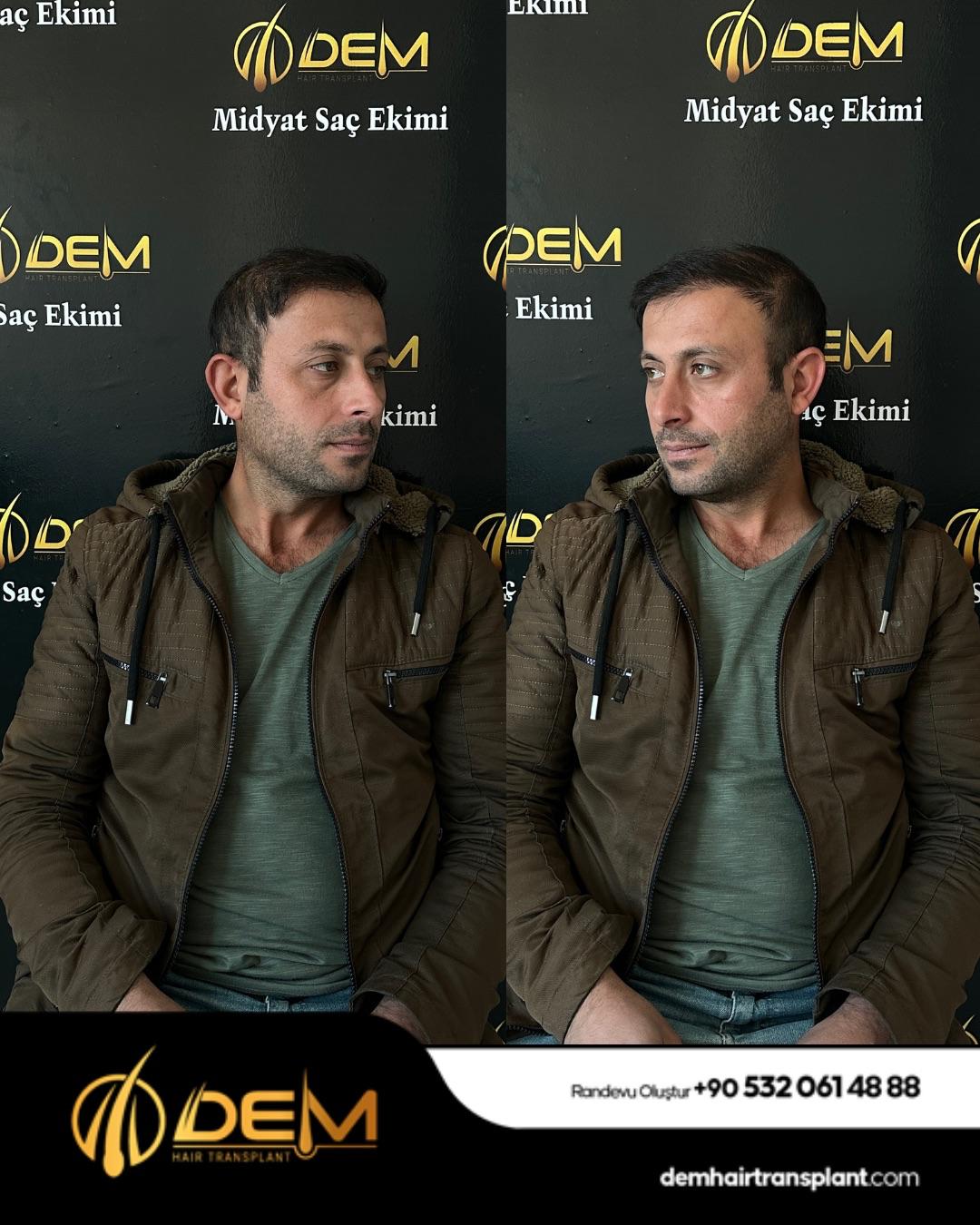 DEM sonuç 31