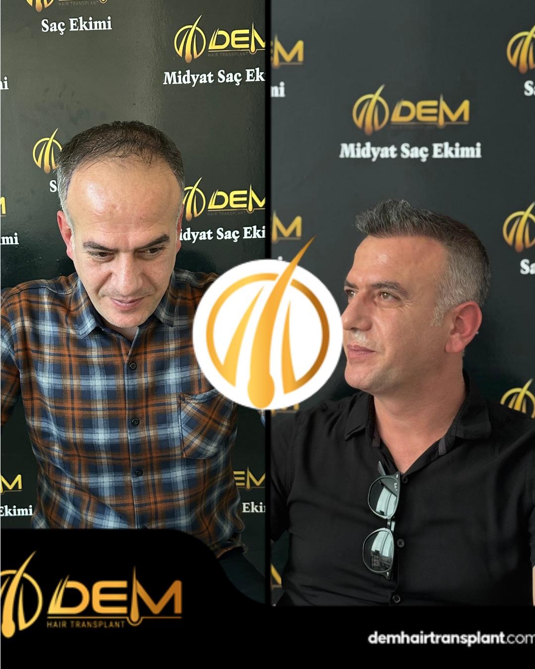DEM sonuç 32