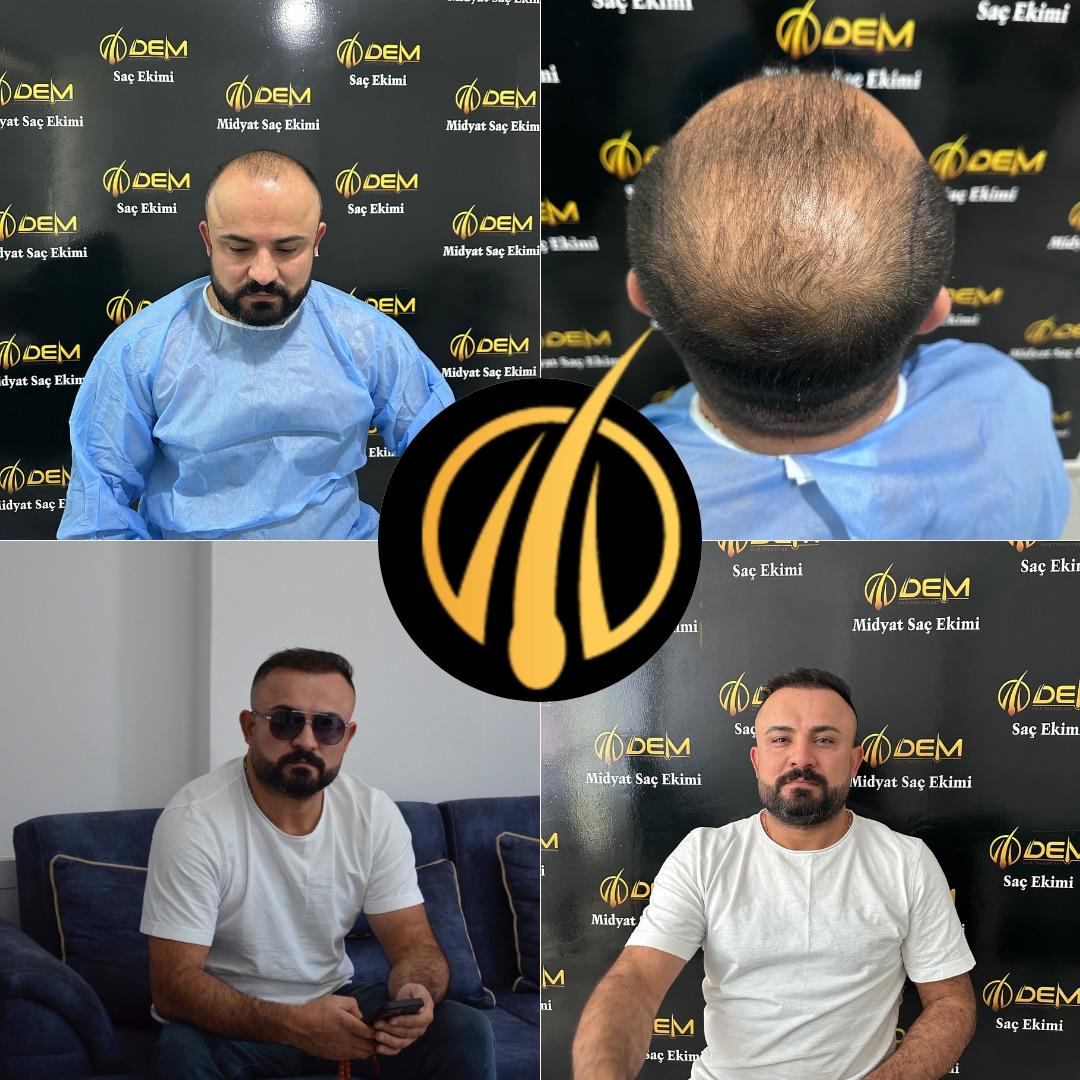DEM sonuç 38
